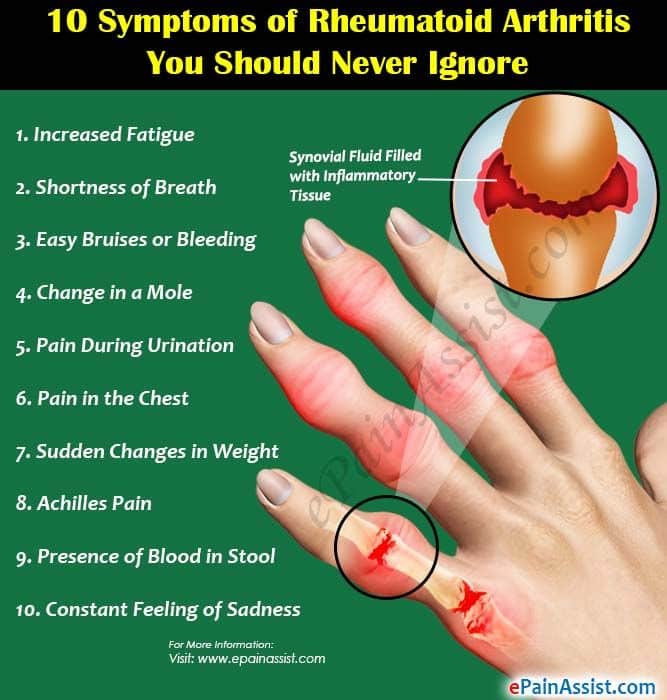 10 Symptoms of Rheumatoid Arthritis You Should Never Ignore ...