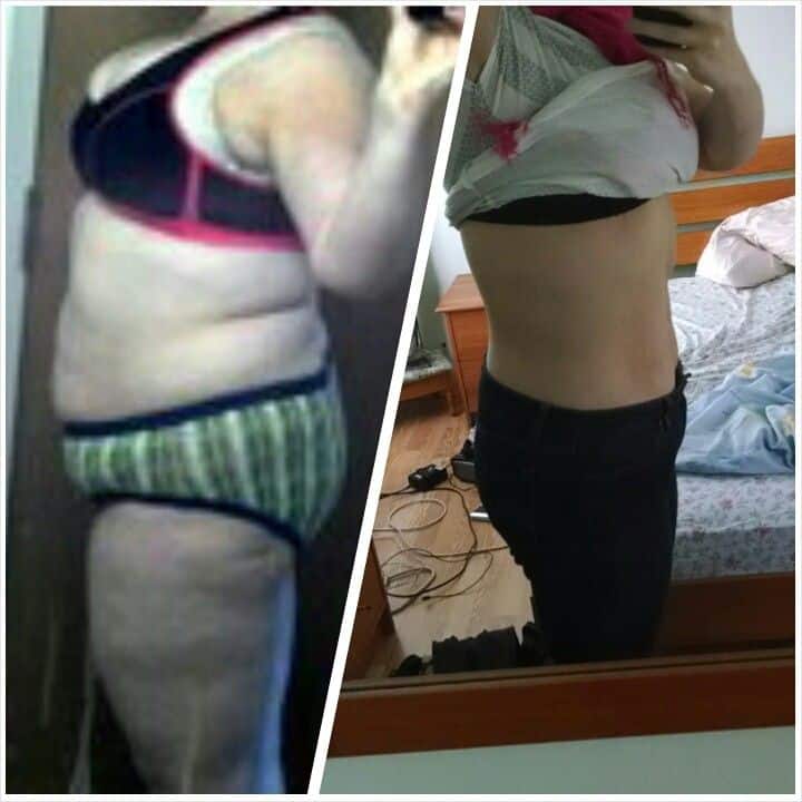 150 Pound Weight Loss No Loose Skin