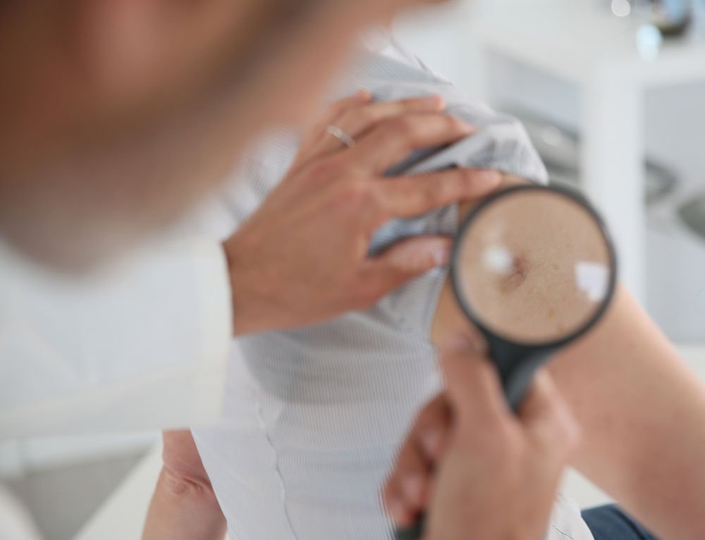 4 Ways Dermatology Can Spot Skin Cancer Symptoms
