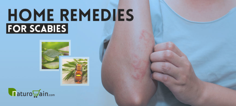 7 Best Home Remedies for Scabies to Prevent Skin Rashes