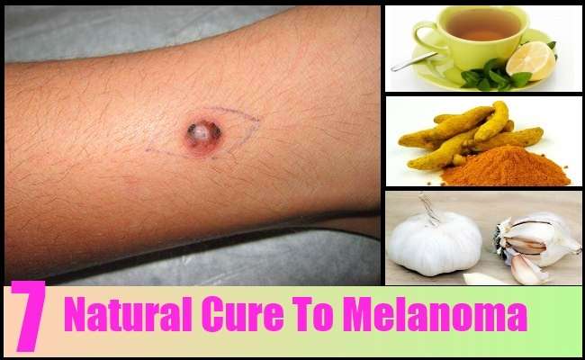 7 Best Natural Cures For Melanoma