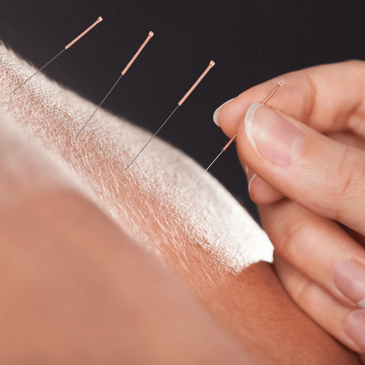 Acupuncture, Aromatherapy