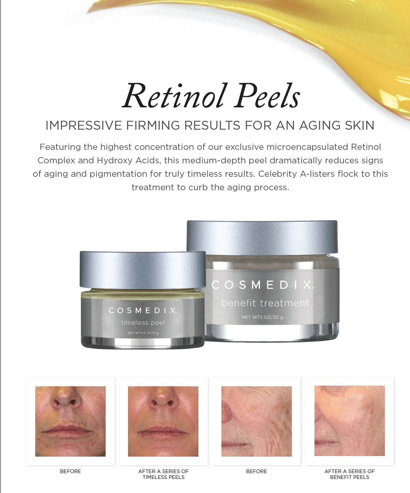 Ageless Peels from Cosmedix. Best purchased in a course of 6.