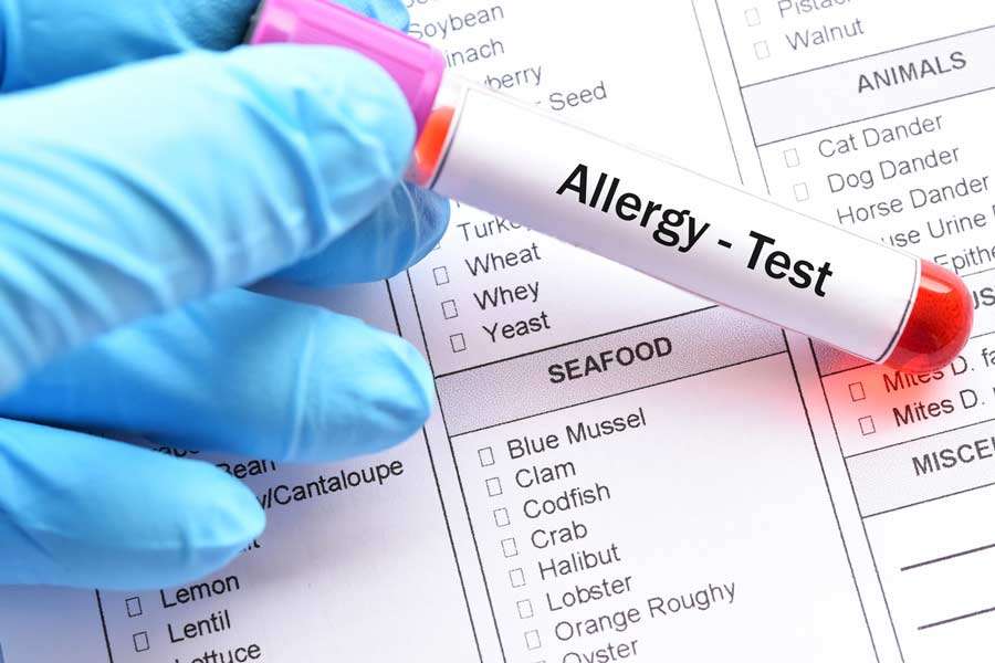 Allergy Testing in Singapore : DB Clinic