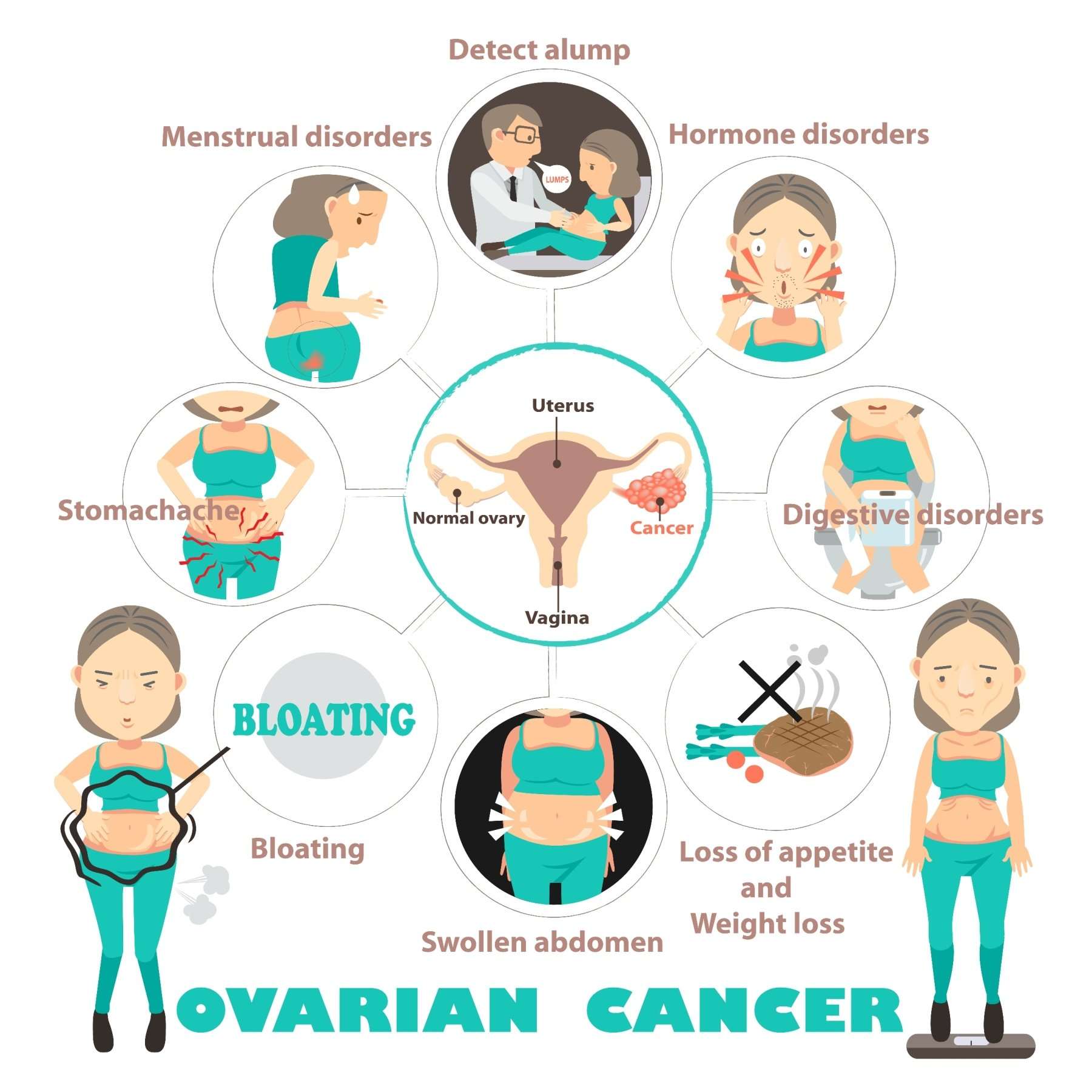 BE AWARE OF THE FOUR MAIN SYMPTOMS OF OVARIAN CANCER:
