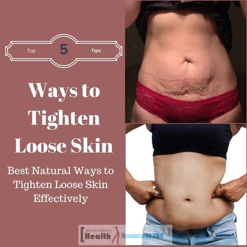 Best Natural Ways to Tighten Loose Skin Effectively : Causes of Loose ...
