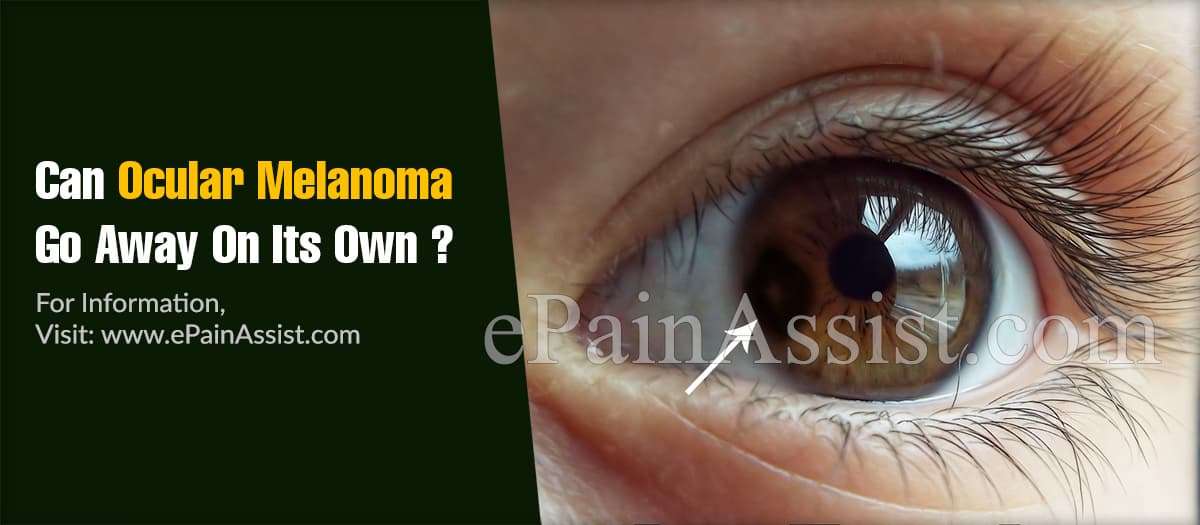 Can Ocular Melanoma Go Away On Its Own &  What Are Its ...