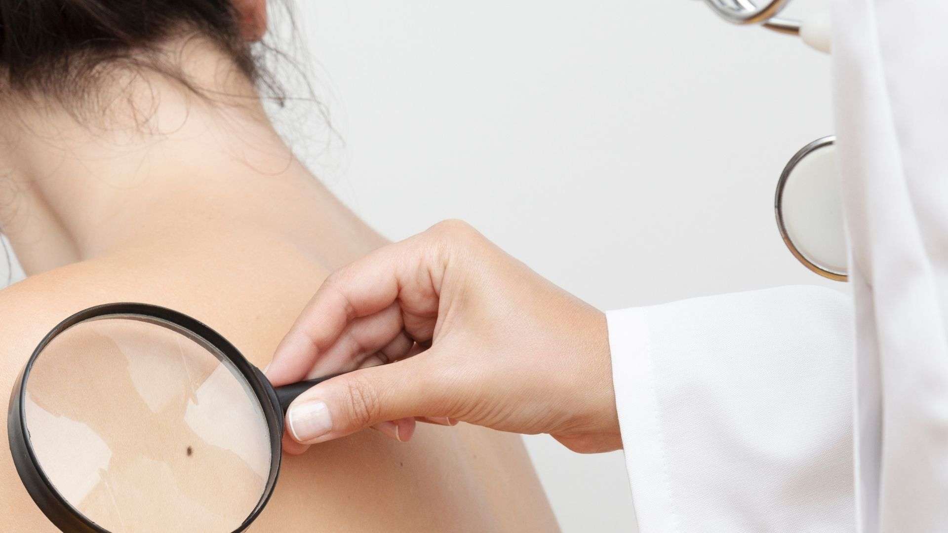 Can Skin Cancer Be Deadly?