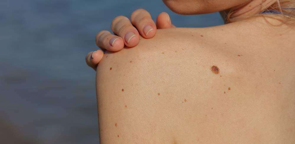 Can you feel skin cancer? All of your important questions ...