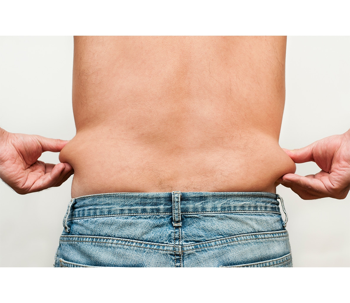 Can You Get Rid of Loose Skin After Major Weight Loss?