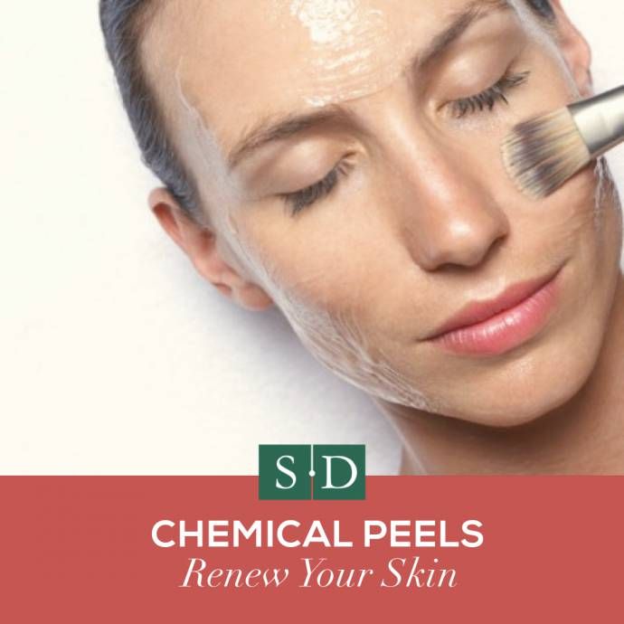 Chemical Peels: Now Available at Shelby Dermatology! ðð?¼ Read our latest ...