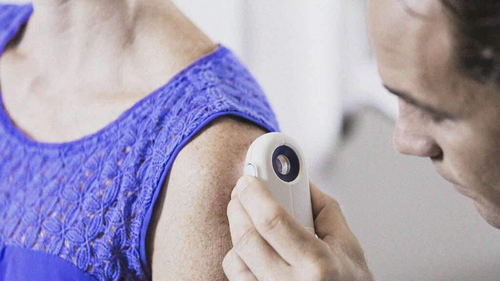 Does Medicare cover skin cancer care? Screening and more