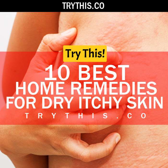 Dry Itchy Skin? 10 Best Home Remedies for Dry Itchy Skin