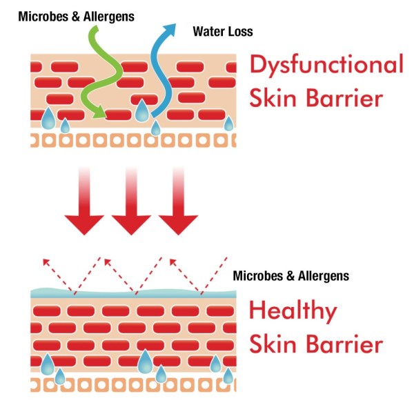 Dysfunctional Skin Barriers: What Are They? And How Do You Repair Them ...