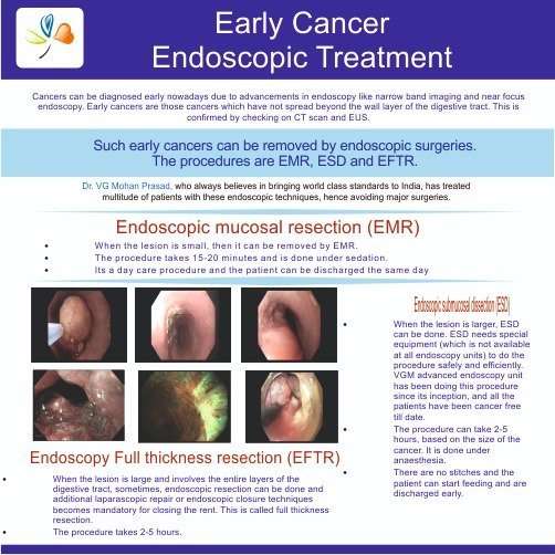 Early Cancer Endoscopic Treatment