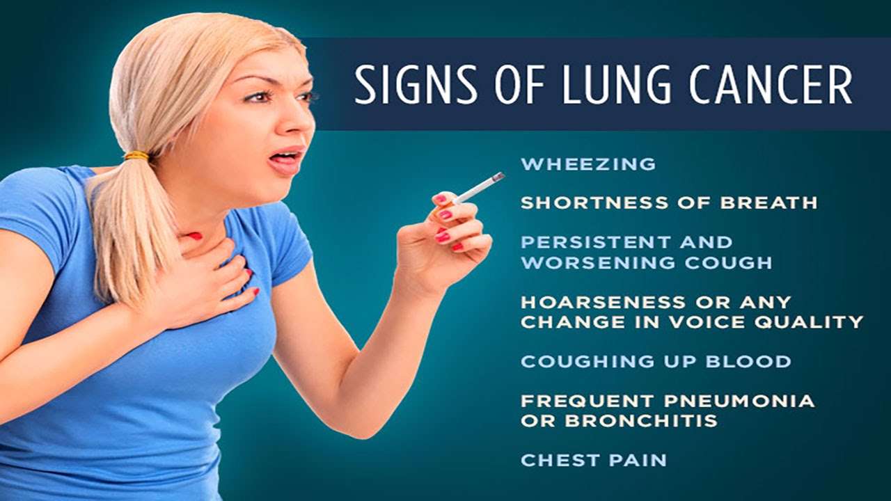 Early sign of lung cancer you should know about ...