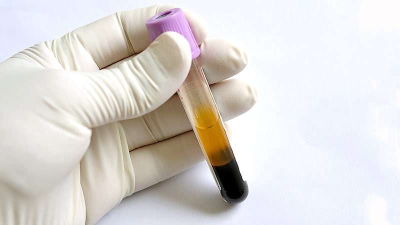 Experimental Blood Test Detects Cancer Years Before Symptoms
