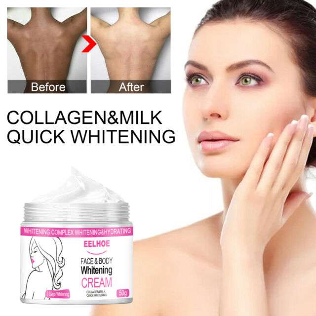 Expigment 30g 1oz Hydroquinone 4 Cream Skin Bleaching Lightening ...