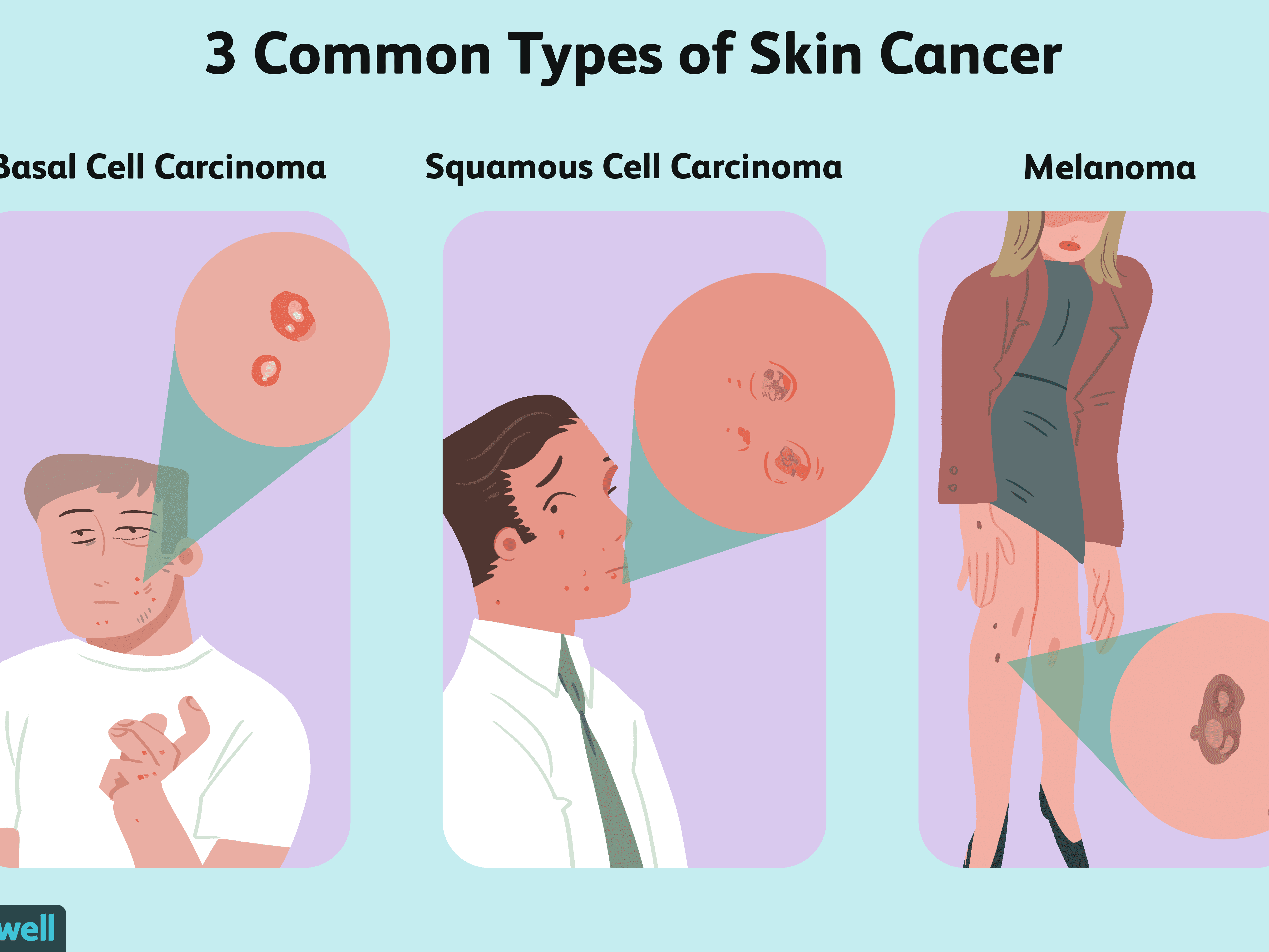 Face Skin Cancer Signs And Symptoms