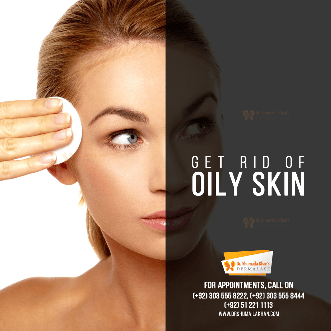Get Rid of Oily Skin
