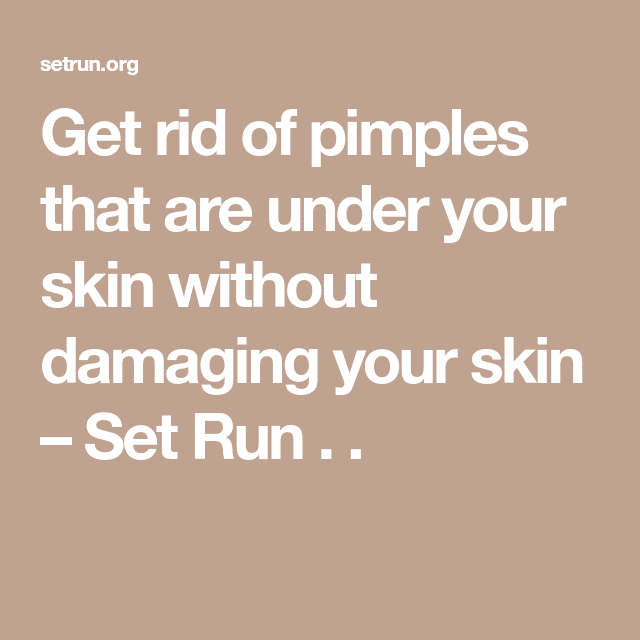 Get rid of pimples that are under your skin without damaging your skin ...