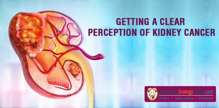 Getting A Clear Perception Of Kidney Cancer