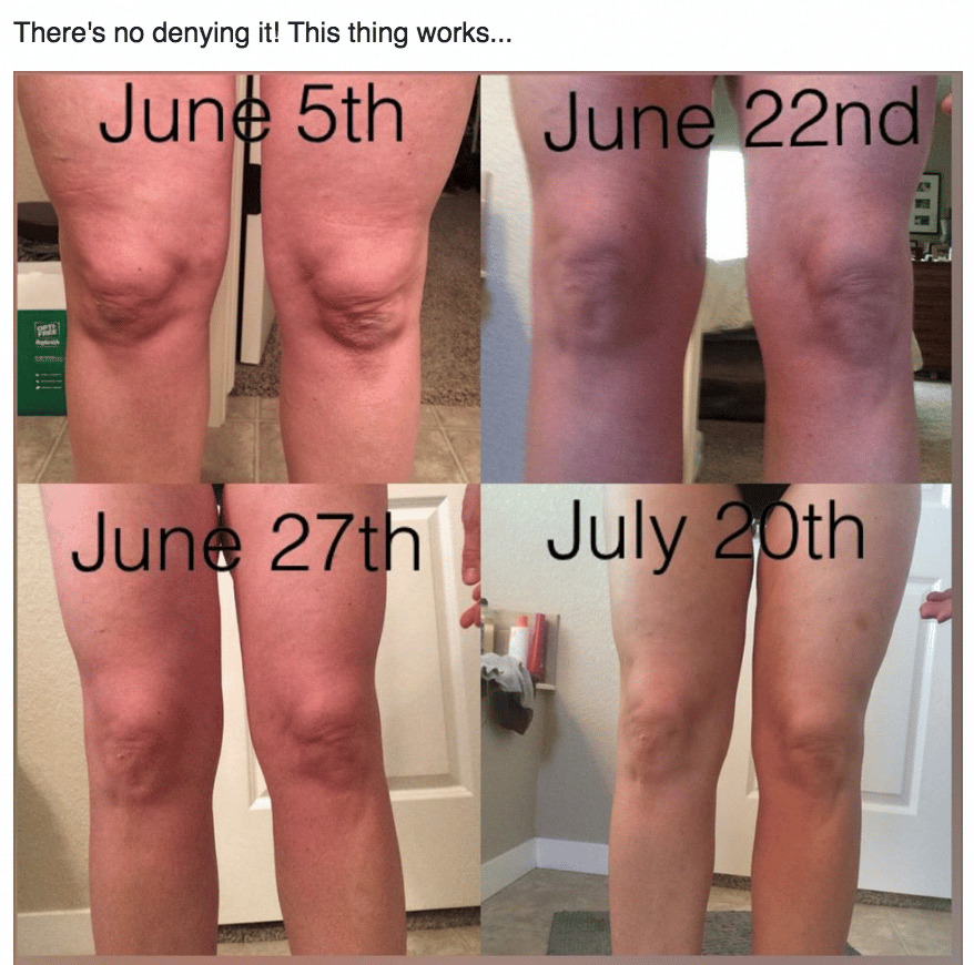 Her knees are so much tighter! Want to FIX and tighten up your loose ...