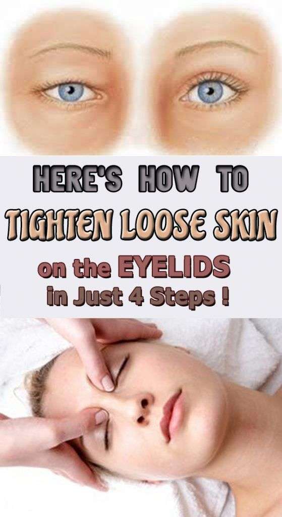 Heres How to Tighten Loose Skin on the Eyelids in Just 4 Steps ...