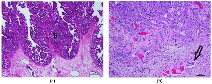 Histology of canine transitional cell carcinoma specimens ...