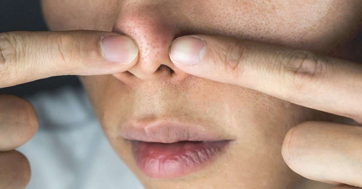Holes In Skin Around Nose
