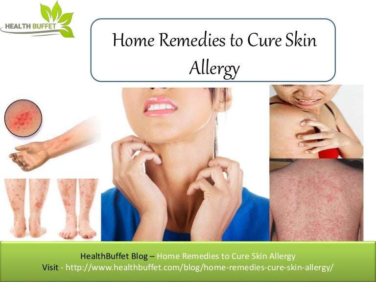Home Remedies to Cure Skin Allergy