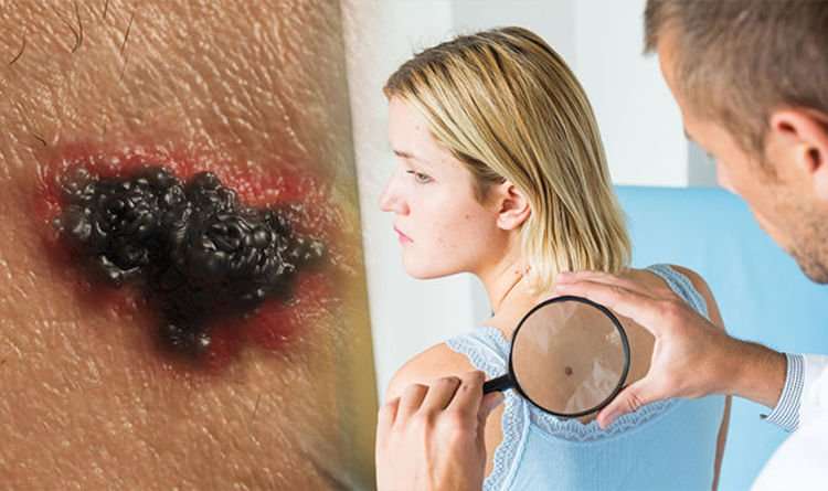 How Can Doctors Tell If You Have Skin Cancer ...