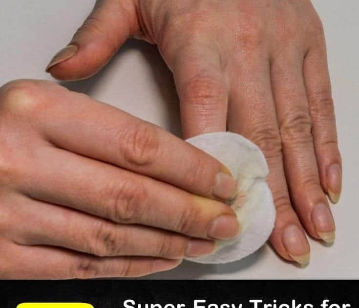 How Can Remove Super Glue From Your Skin