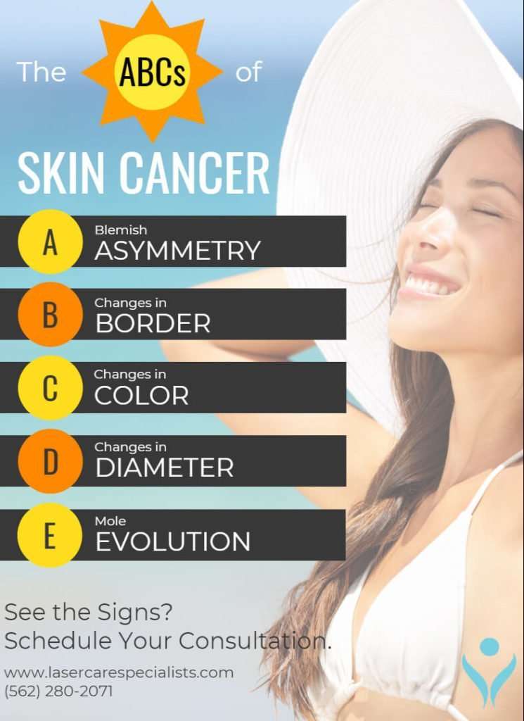 How Often Should I Get Checked for Skin Cancer?