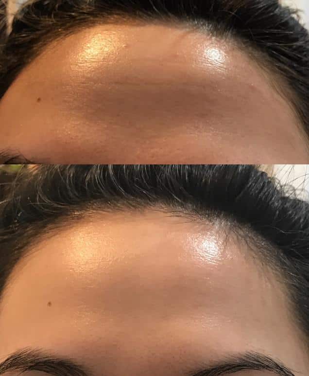 How to Fix Dehydrated Skin: Fix Your Moisture Barrier!  Leaked Beauty