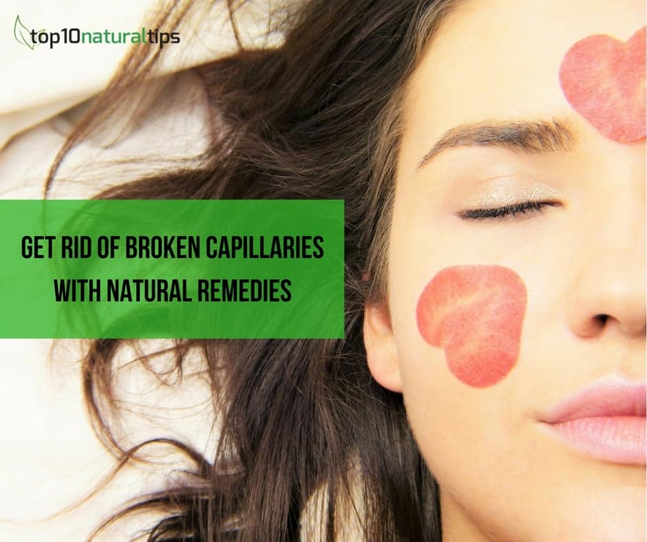 How to get rid of broken capillaries on face naturally