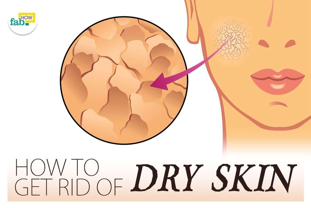 How to Get Rid of Dry, Itchy Skin at Home