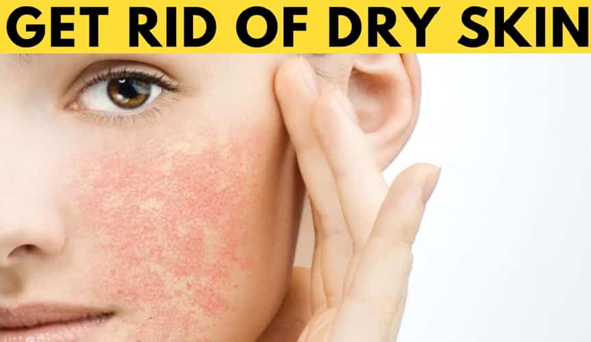 How to get rid of dry skin on face