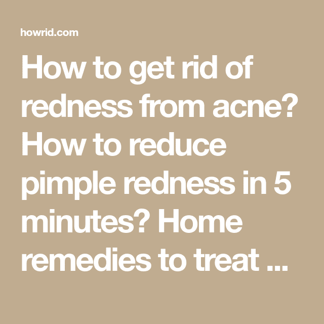 How to Get Rid Of Redness From Acne And Pimples? (Fast &  Naturally ...