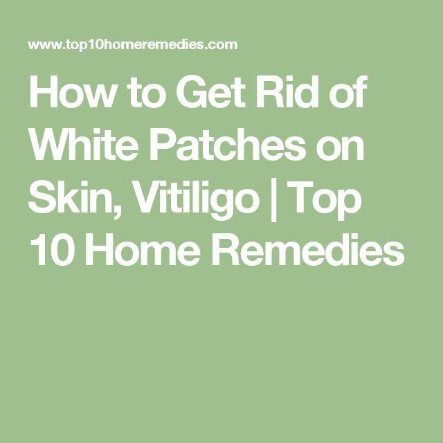 How to Get Rid of White Patches on Skin, Vitiligo