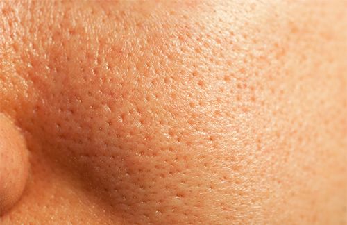 How To Improve Skin Texture