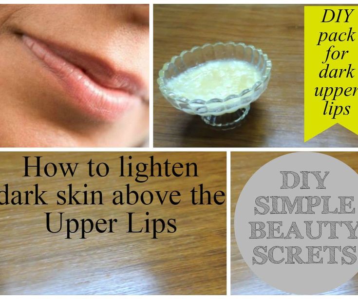 How to Lighten Dark Skin Above the Upper Lips  Home Remedies