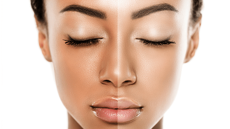 How to Lighten Skin Fast, Overnight, Naturally, Permanently, Home ...