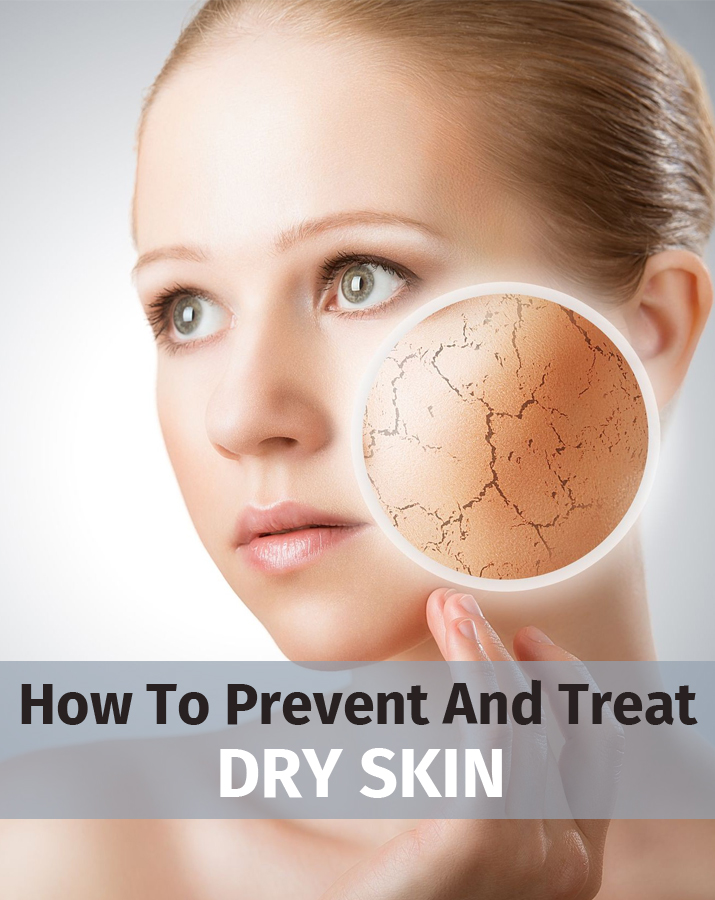 How to prevent and treat dry skin