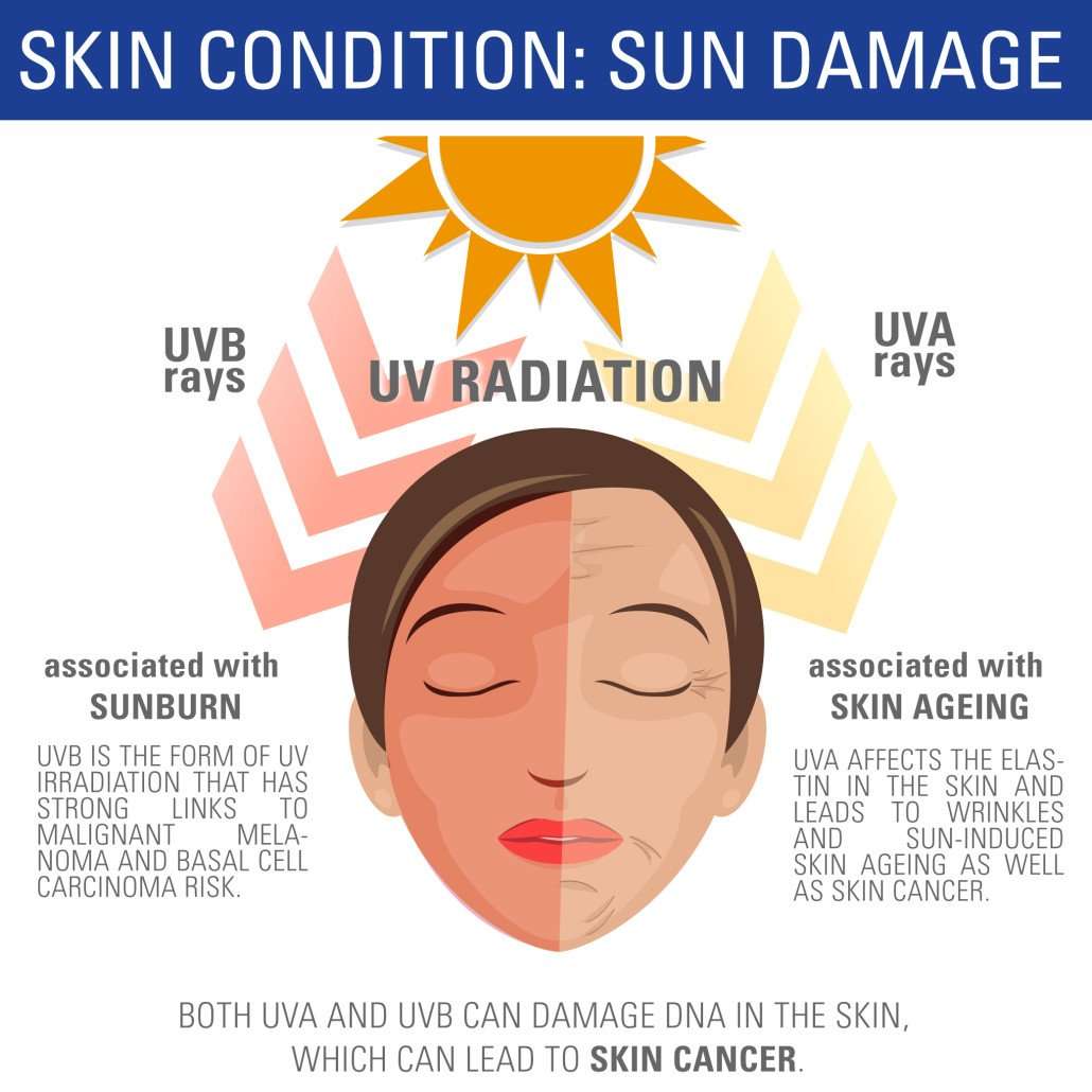 How to protect your skin from sun damage. INFOGRAPHIC