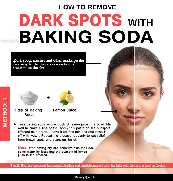 How to Remove Dark Spots with Baking Soda Naturally