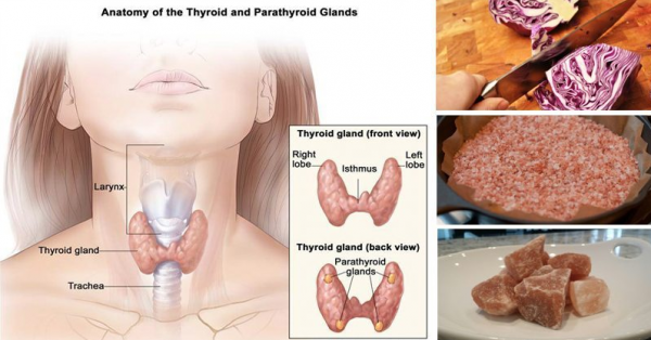Hypothyroidism Or Underactive Thyroid Gland Can Cause ...