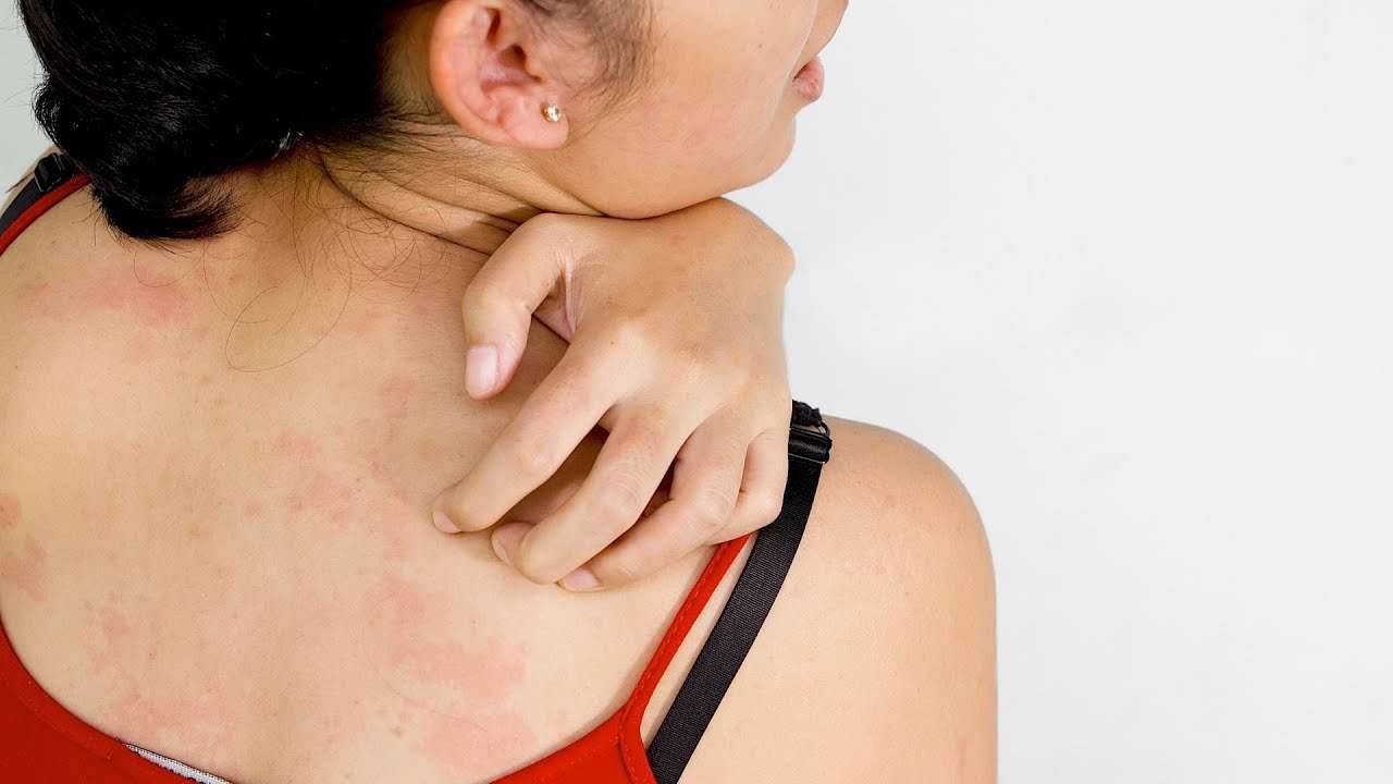 Is Itchy Skin a Sign of Skin Cancer?