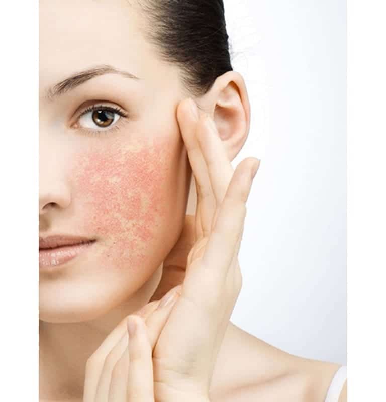 Is your skin sensitive or sensitized? â The Banwell Clinic
