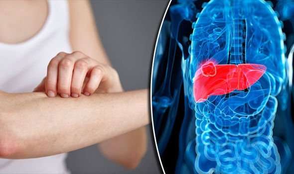Liver cancer symptoms: Nine signs you could be suffering ...